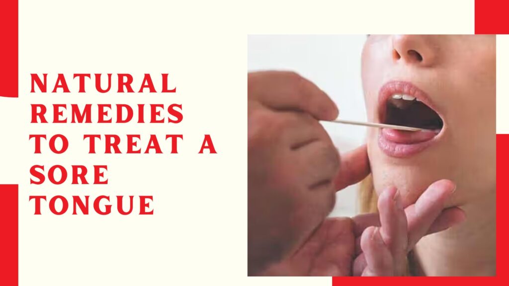 Natural Remedies to Treat a Sore Tongue