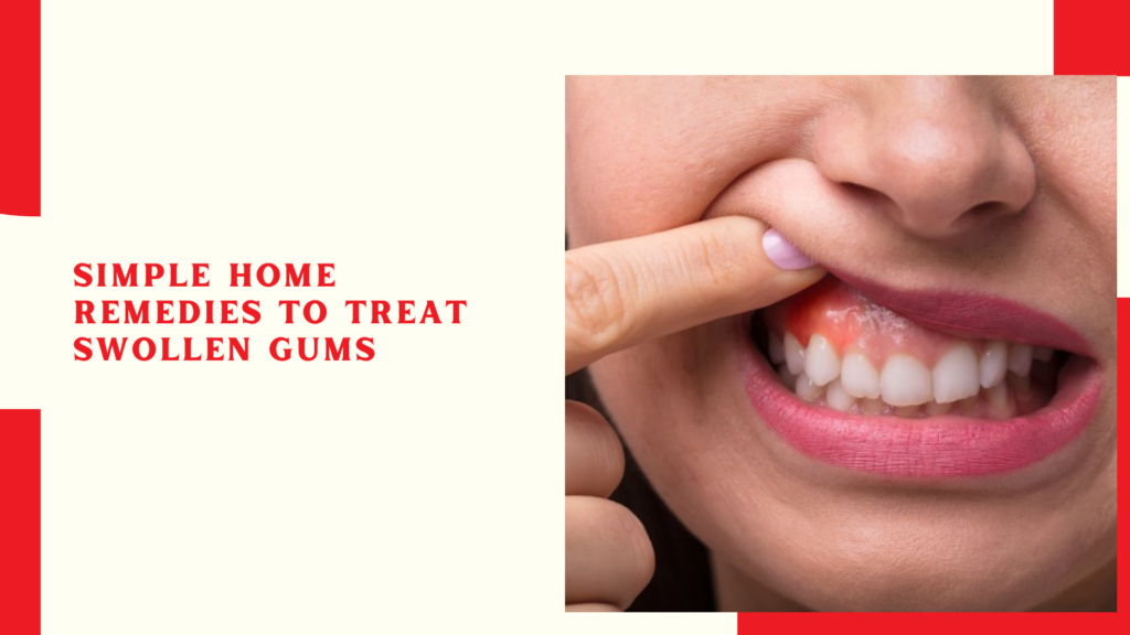 Simple Home Remedies To Treat Swollen Gums