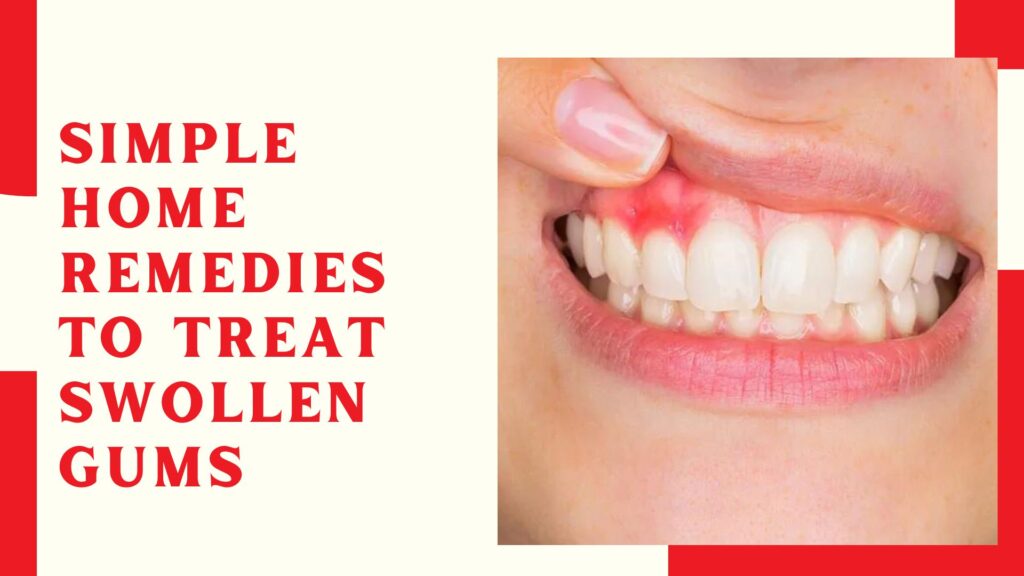 Simple-home-remedies-to-treat-swollen-gums.jpg