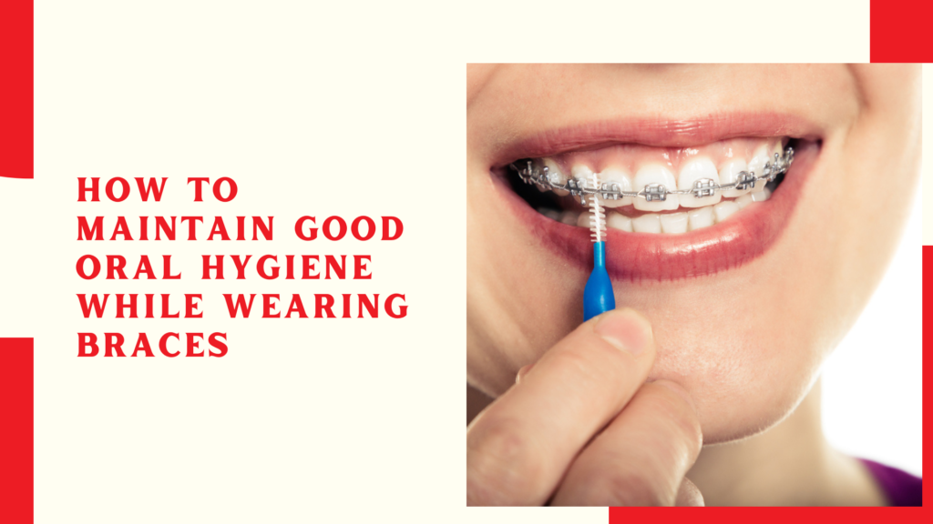 How to Maintain Good Oral Hygiene While Wearing Braces