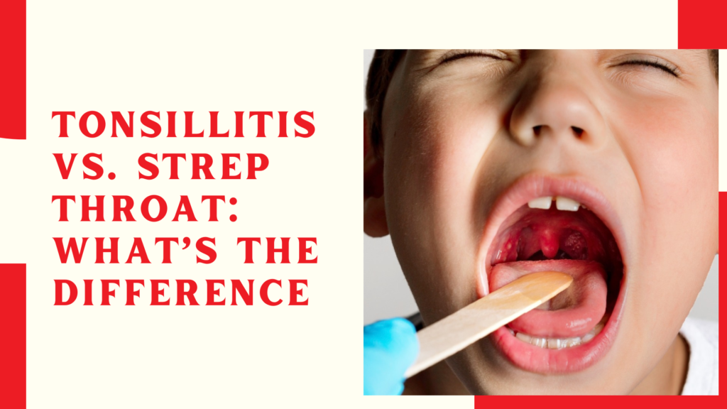 Tonsillitis vs. Strep Throat What’s the Difference