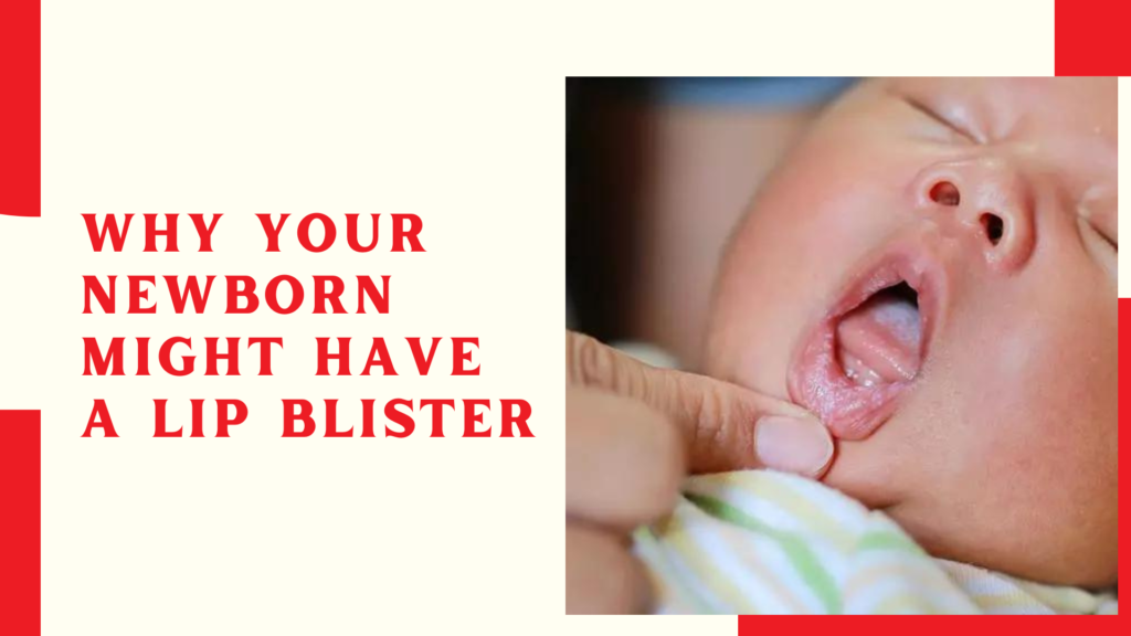 Why Your Newborn Might Have a Lip Blister