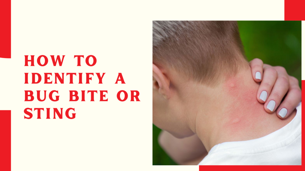 how to identify a bug bite or sting