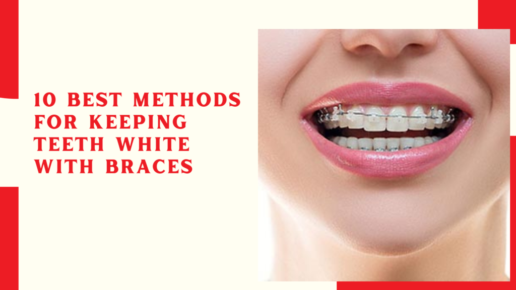 10 Best Methods for Keeping Teeth White With Braces