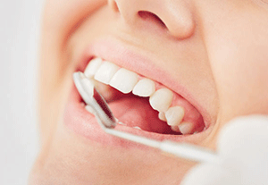 Promotes-Better-Oral-Health