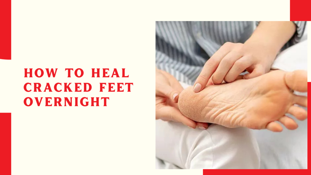 How to heal cracked feet overnight